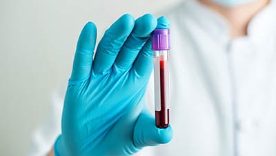 Рука в медицинской перчатке держит пробирку с кровью